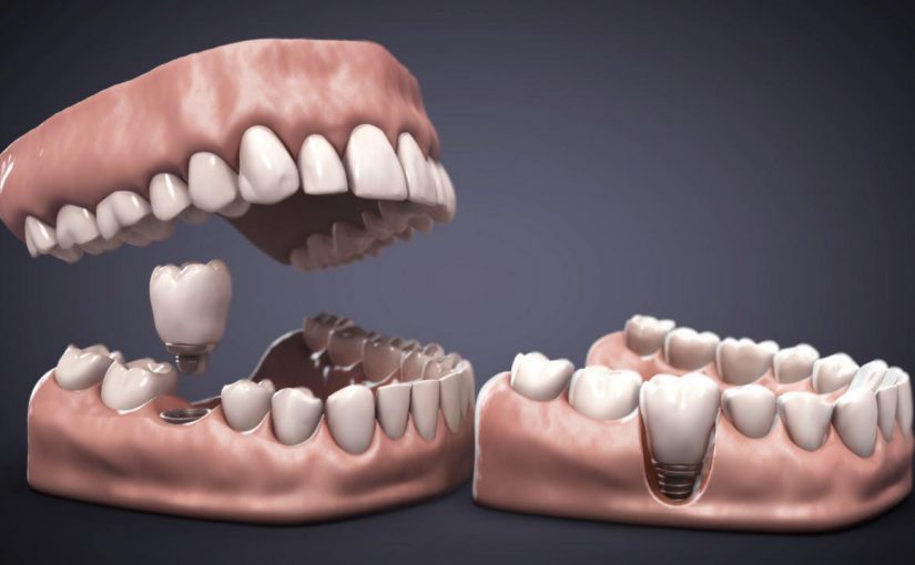 Odontología 3D