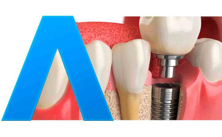 Odontologia-3D-Imágenes-dentales-3D-animación-3D-para-dentistas-paquetes-de-vídeos-de-enfermedades-y-procesos-y-programación-360-dental-para-pedagogía-interactiva​-GrupoAudiovisual