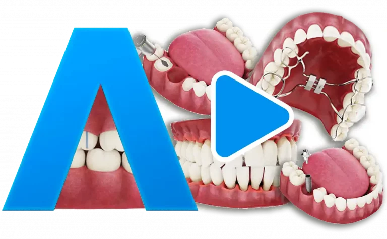 Paquetes de videos dentales 3d odontologos Odontologia en video para pedagogia clinicas dentales clinica