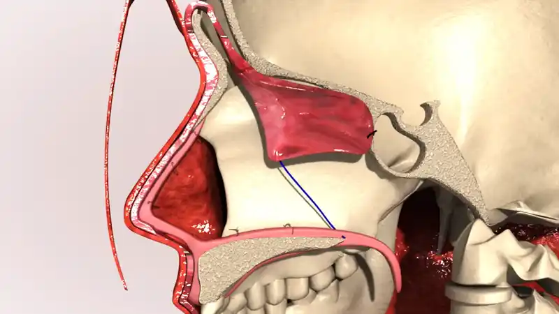 Intervención de tabique nasal cirugía estética en animación 3D grupoaudiovisual