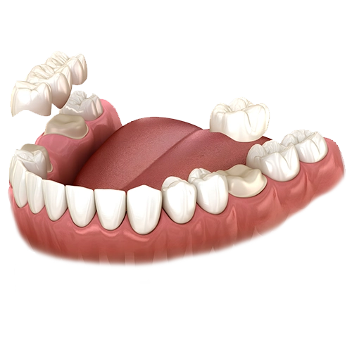 Animación 3D para Odontología Procedimientos y Tratamientos con Realismo GrupoAudiovisual imagen 3d personalizado ok