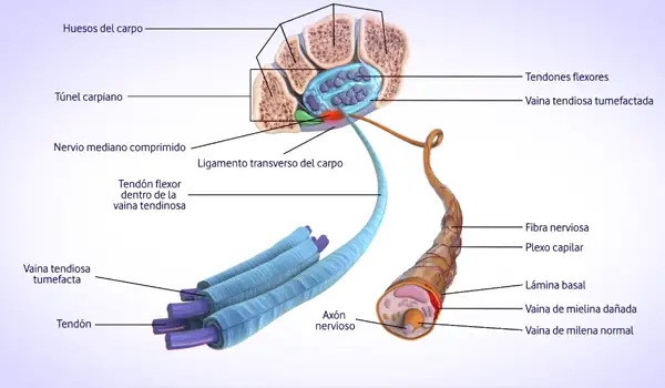 Imagen de proyecto Animación 3D Médica sobre Radiculopatías y Síndromes Canaliculares Grupo Audiovisual 01