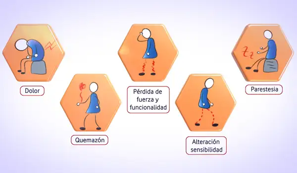 Imagen de proyecto Animación 3D Médica sobre Radiculopatías y Síndromes Canaliculares Grupo Audiovisual 03