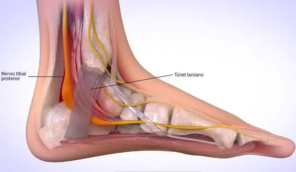 Imagen de proyecto Animación 3D Médica sobre Radiculopatías y Síndromes Canaliculares Grupo Audiovisual 06