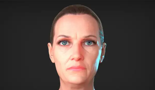 Proyecto Animación 3D Profesional para Cirugía Estética grupo audiovisual imagen 01