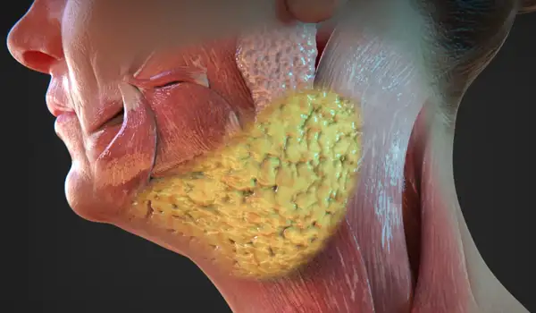 Proyecto Animación 3D Profesional para Cirugía Estética grupo audiovisual imagen 02